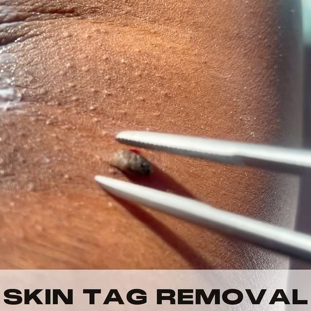 Beauty Secret Skin Care Spa